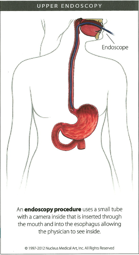 lower endoscopy procedure